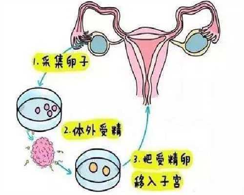 探索代孕服务：为您的生育之旅提供专业支持